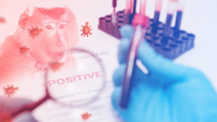 Strain Berhasil Diisolasi, Seberapa Jauh Vaksin Cacar Monyet di China?