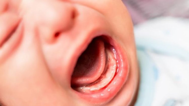 Kemenkes Buka Suara Usai Bayi Berumur 54 Hari Meninggal Minum Ramuan Tradisional