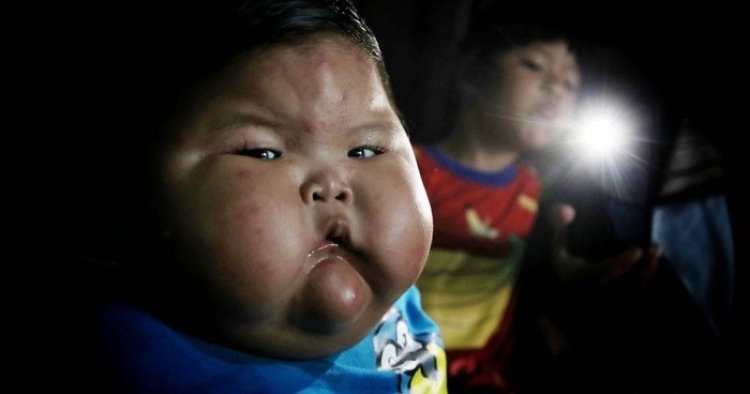 Bayi Obesitas di Bekasi Bakal Jalani Program Penurunan Berat Badan