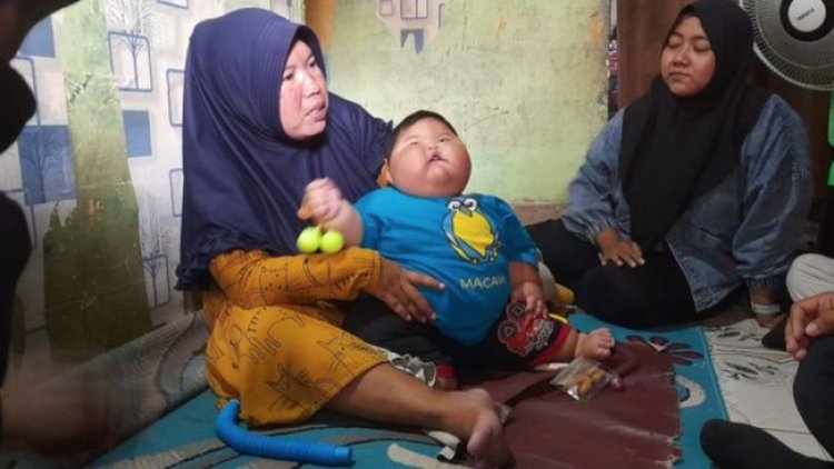 Khawatir Ada Penyakit Lain, Bayi Obesitas di Bekasi Dirujuk ke RSCM