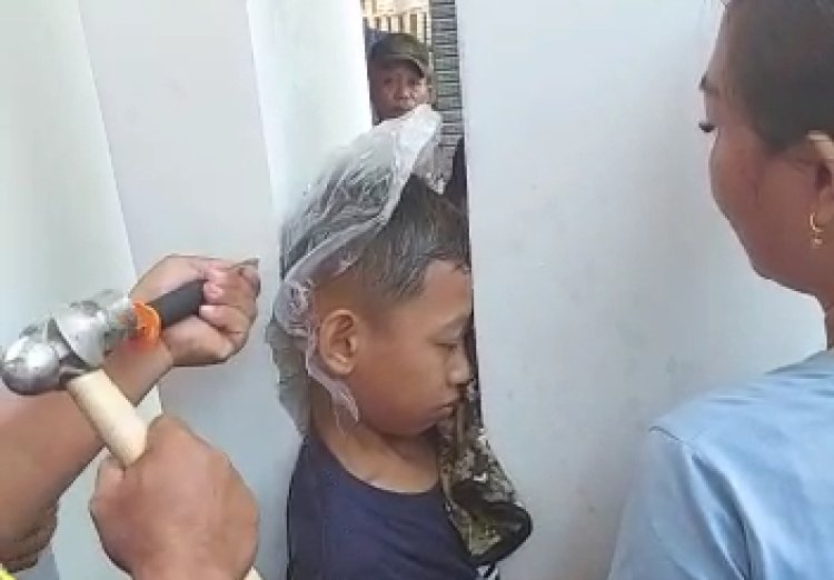 Tangis Bocah 8 Tahun di Madiun, Kepalanya Terjepit Pilar Beton Rumahnya