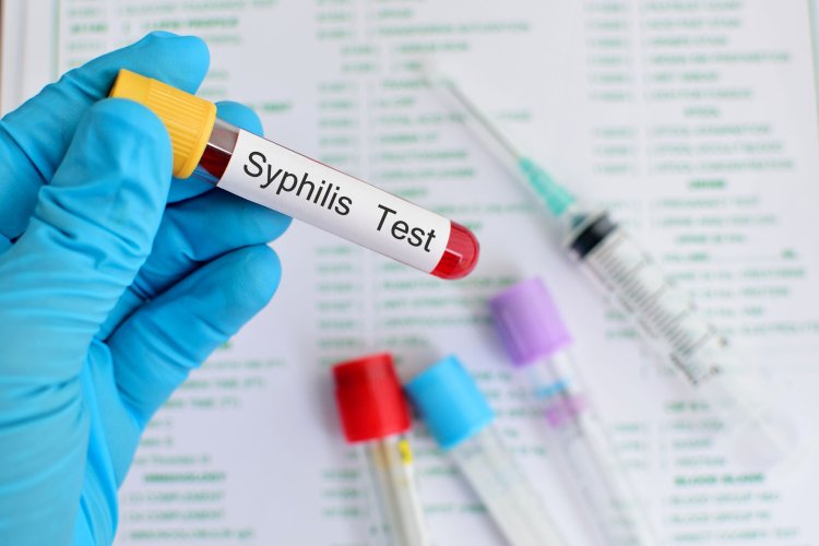 Duh! Kasus Sifilis di RI Meningkat, Kemenkes Ungkap Penyebabnya